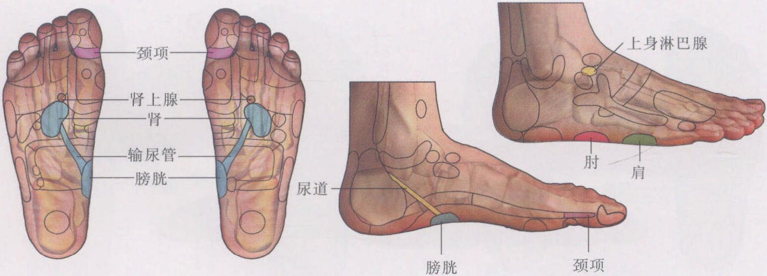 網(wǎng)球肘